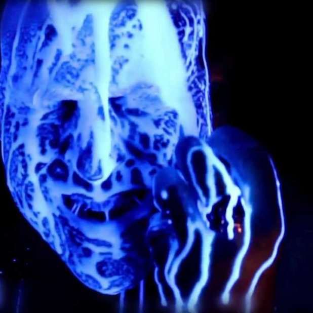 kevorkian death cycle mind decay